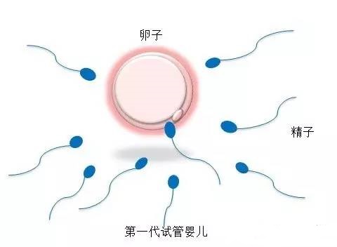 靠谱孕妈供卵代孕包生儿子